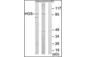 Western blot analysis of extracts from 293/HuvEc cells, using HGS Antibody. (HGS antibody  (Internal Region))