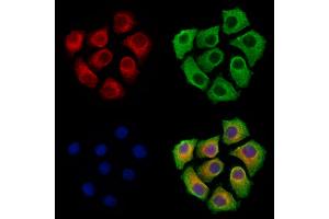 ABIN7094862 and ABIN7098913 staining Hela cells by IF/ICC. (HAS2 antibody  (C-Term))