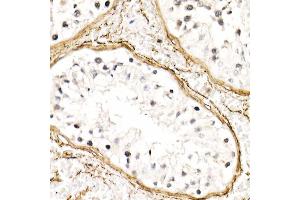 Immunohistochemistry (IHC) image for anti-Fibrillin 1 (FBN1) (AA 360-460) antibody (ABIN7267176)