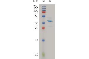 Human SLPI Protein, hFc Tag on SDS-PAGE under reducing condition.