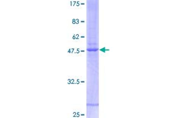 IFNA21 Protein (AA 1-189) (GST tag)