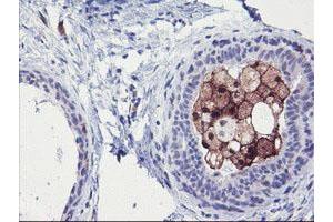 Immunohistochemical staining of paraffin-embedded Human breast tissue using anti-SDS mouse monoclonal antibody.