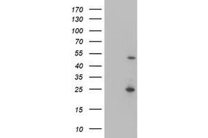 Western Blotting (WB) image for anti-Myocyte Enhancer Factor 2C (MEF2C) antibody (ABIN1499363) (MEF2C antibody)