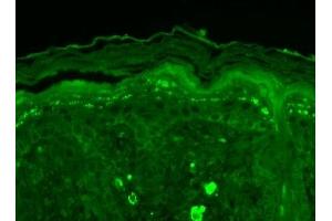 Immunohistochemistry analysis using Mouse Anti-SHANK3 Monoclonal Antibody, Clone S69-46 (ABIN863129). (SHANK3 antibody  (AA 840-857))