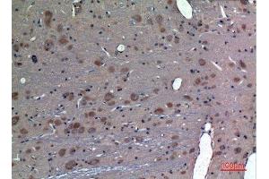 Immunohistochemistry (IHC) analysis of paraffin-embedded Rat Brain, antibody was diluted at 1:100. (PREP antibody  (N-Term))