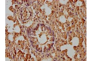 IHC image of ABIN7176993 diluted at 1:400 and staining in paraffin-embedded mouse lung tissue performed on a Leica BondTM system. (beta-2 Microglobulin antibody  (AA 21-119))