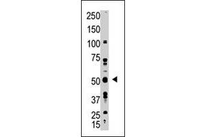 The GDF10 polyclonal antibody  is used in Western blot to detect GDF10 in A-375 cell lysate. (GDF10 antibody  (N-Term))