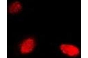 Immunofluorescent analysis of NUDT2 staining in Hela cells. (NUDT2 antibody)