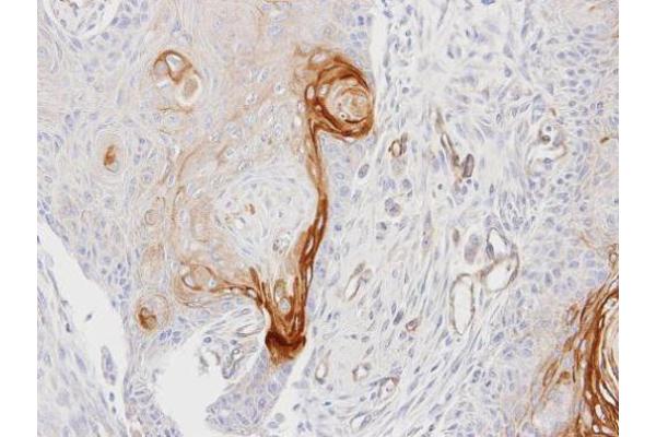 ENTPD6 antibody  (Center)