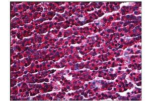 Immunohistochemistry (IHC) image for anti-Protein Kinase, Interferon-Inducible Double Stranded RNA Dependent Activator (PRKRA) antibody (ABIN781891) (PRKRA antibody)