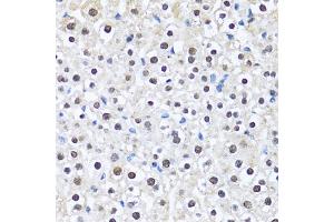 Immunohistochemistry of paraffin-embedded mouse liver using CCAR2 antibody. (CCAR2 antibody)