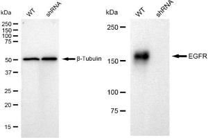 Western blotting analysis using EGFR antibody (ABIN7798462). (Recombinant EGFR antibody)