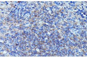 Immunohistochemistry of paraffin-embedded Mouse spleen using CSF3 Polyclonal Antibody at dilution of 1:100 (40x lens). (G-CSF antibody)