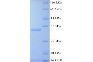 SDS-PAGE (SDS) image for Placenta Growth Factor (PGF) (AA 19-170) protein (His-SUMO Tag) (ABIN5710083) (PLGF Protein (AA 19-170) (His-SUMO Tag))