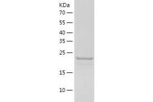 Western Blotting (WB) image for Small Nuclear Ribonucleoprotein Polypeptide B (SNRPB2) (AA 1-225) protein (His tag) (ABIN7125132)