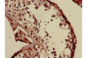 Immunohistochemistry of paraffin-embedded human testis tissue using ABIN7174238 at dilution of 1:100 (COQ6 antibody  (AA 208-339))