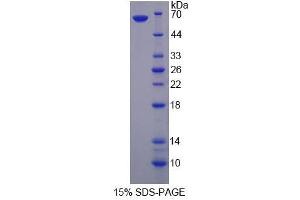 Image no. 1 for tau Tubulin Kinase 2 (TTBK2) (AA 21-314) protein (His tag,GST tag) (ABIN6237363) (TTBK2 Protein (AA 21-314) (His tag,GST tag))