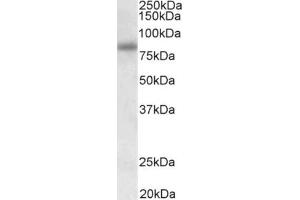 AP31940PU-N SDCCAG8 staining of HEK293 lysate at 0. (SDCCAG8 antibody  (Internal Region))