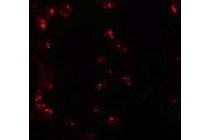 Immunofluorescencent staining of 293 cells with KPNA6 polyclonal antibody  at 20 ug/mL.