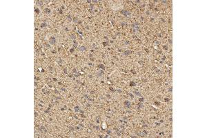 IHC analysis of SPTBN2 using anti-SPTBN2 antibody (ABIN7602111).