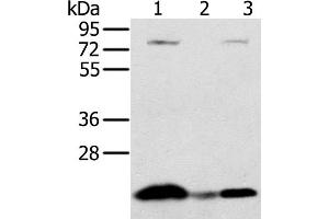 Western Blot analysis of Raji cell and Human liver cancer tissue, hela cell using NDUFAF2 Polyclonal Antibody at dilution of 1:250 (NDUFAF2 antibody)