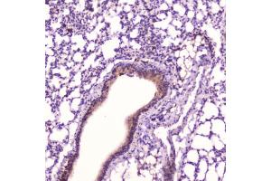 IHC testing of FFPE mouse lung tissue with Leptin antibody at 2ug/ml. (Leptin antibody  (AA 22-167))