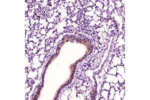 IHC testing of FFPE mouse lung tissue with Leptin antibody at 2ug/ml.