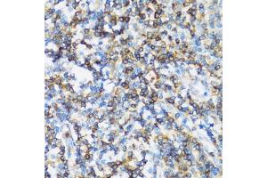 Immunohistochemistry of paraffin-embedded human tonsil using  antibody (ABIN1678742, ABIN3018765, ABIN3018766 and ABIN5664716) at dilution of 1:100 (40x lens). (ARHGEF1 antibody  (AA 783-912))