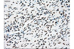 Immunohistochemical staining of paraffin-embedded Kidney tissue using anti-TYRO3mouse monoclonal antibody. (TYRO3 antibody)