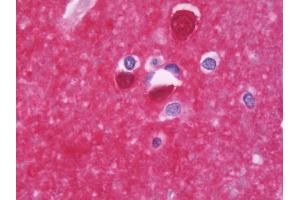 Anti-PPP3CB antibody IHC staining of human brain, cortex. (PPP3CB antibody  (AA 63-393))