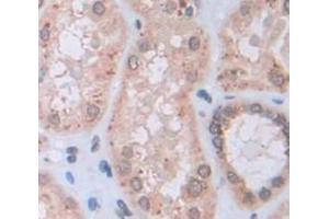 IHC-P analysis of Human Tissue, with DAB staining. (IDS antibody  (AA 95-289))