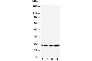 Western Blotting (WB) image for anti-Caveolin 2 (CAV2) (AA 1-17) antibody (ABIN3030339)