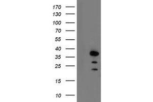 HEK293T cells were transfected with the pCMV6-ENTRY control (Left lane) or pCMV6-ENTRY AIP (Right lane) cDNA for 48 hrs and lysed. (AIP antibody)