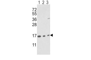 Western Blotting (WB) image for anti-Peptidylprolyl Isomerase A (Cyclophilin A) (PPIA) antibody (ABIN3001732)