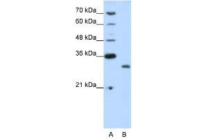 CPXCR1 antibody (20R-1231) used at 0. (CPXCR1 antibody  (N-Term))