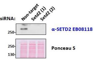 ABIN238587 (0. (SETD2 antibody  (Internal Region))
