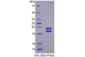 SDS-PAGE analysis of Mouse SPD Protein. (SFTPD Protein)