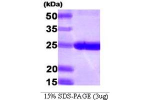 SDS-PAGE (SDS) image for Proteasome (Prosome, Macropain) Subunit, beta Type, 1 (PSMB1) (AA 30-241) protein (His tag) (ABIN668041) (PSMB1 Protein (AA 30-241) (His tag))