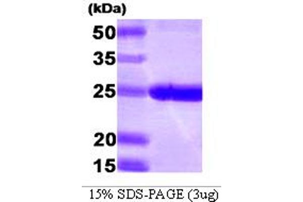 PSMB1 Protein (AA 30-241) (His tag)