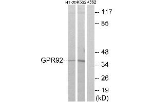Western blot analysis of extracts from HT-29 cells and K562 cells, using GPR92 antibody. (LPAR5 antibody  (Internal Region))