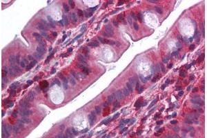 Human Small Intestine (formalin-fixed, paraffin-embedded) stained with TRAF2 antibody ABIN214009 at 5 ug/ml followed by biotinylated goat anti-rabbit IgG secondary antibody ABIN481713, alkaline phosphatase-streptavidin and chromogen. (TRAF2 antibody  (N-Term))