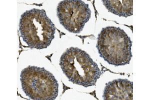IHC analysis of IFT88 using anti-IFT88 antibody (ABIN7600458). (IFT88 antibody  (AA 198-814))