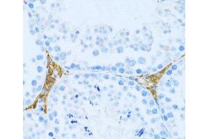 Immunohistochemistry of paraffin-embedded Mouse testis leydig using KLHL42 Polyclonal Antibody at dilution of 1:100 (40x lens). (KLHDC5 antibody)