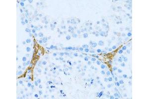 Immunohistochemistry of paraffin-embedded Mouse testis leydig using KLHL42 Polyclonal Antibody at dilution of 1:100 (40x lens).