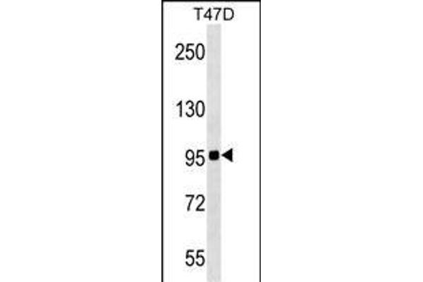 ZNF606 Antikörper  (N-Term)