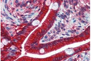 Human Small Intestine: Formalin-Fixed, Paraffin-Embedded (FFPE) (CES2 antibody  (AA 514-622))