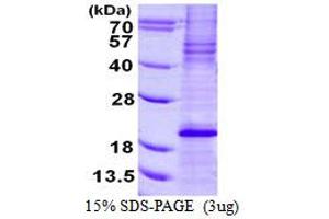 Image no. 1 for BCL2-Like 11 (Apoptosis Facilitator) (BCL2L11) protein (His tag) (ABIN7279918)