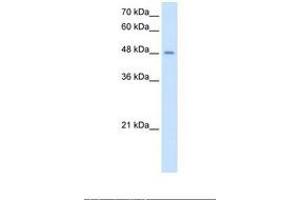 Image no. 1 for anti-Transmembrane Protease, serine 11D (TMPRSS11D) (AA 51-100) antibody (ABIN321109) (TMPRSS11D antibody  (AA 51-100))