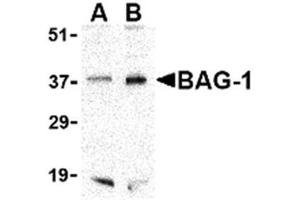 Image no. 1 for anti-BCL2-Associated Athanogene (BAG1) (C-Term) antibody (ABIN318738) (BAG1 antibody  (C-Term))