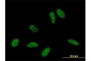 Immunofluorescence of purified MaxPab antibody to RBBP6 on HeLa cell. (RBBP6 antibody  (AA 1-118))